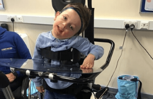 cerebral palsy low tone and hypotonia